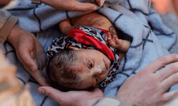 Minik bebeğin elindekiler Türkiye'yi bir kez daha yıktı