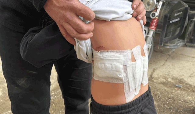 Afyon'da 5 yaşındaki çocuğa eşek saldırdı