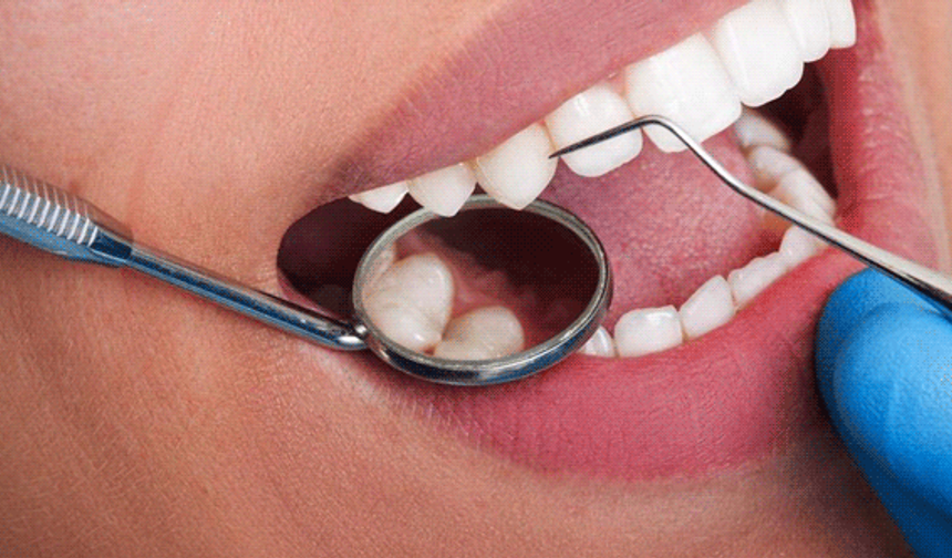 Diş taşı temizliğinde doğru bilinen yanlışlar