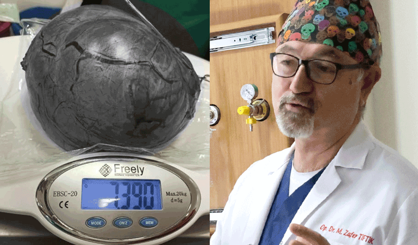 Eskişehir’de doktorları şoke eden olay